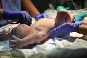birth injury lawyer in Albany, NY